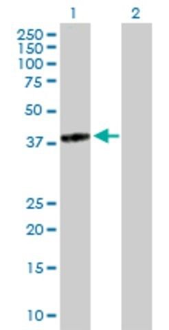 Anti-TGDS antibody produced in mouse