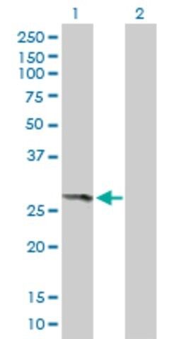 Anti-THEM4 antibody produced in mouse