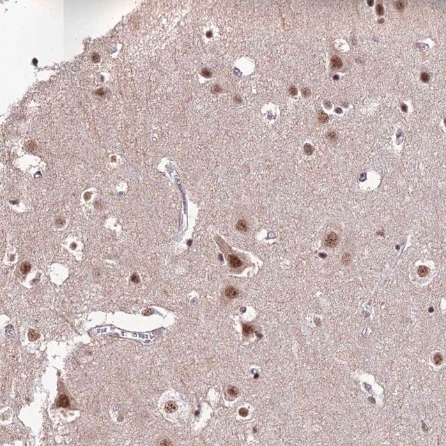 Anti-THOC7 antibody produced in rabbit