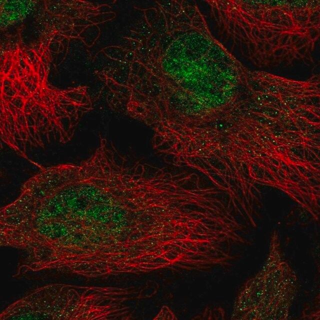 Anti-THOC5 antibody produced in rabbit