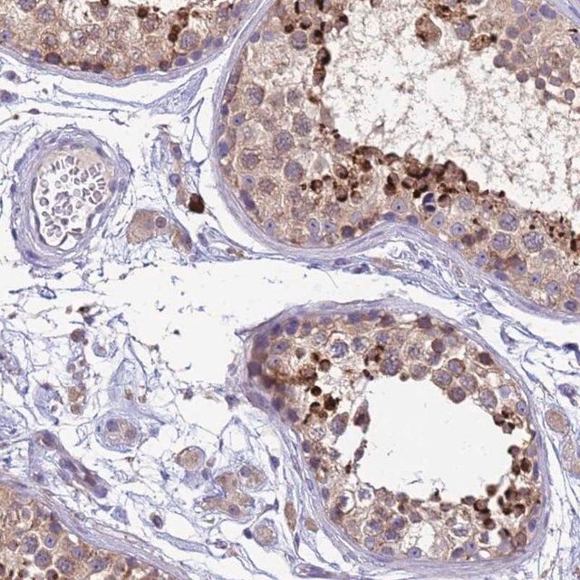 Anti-THAP5 antibody produced in rabbit