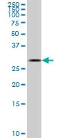 ANTI-TGIF2 antibody produced in mouse