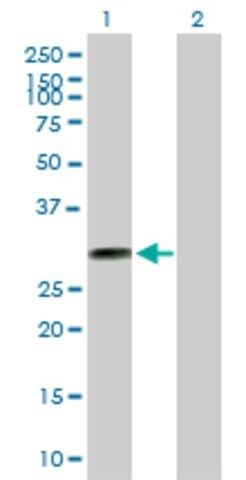 Anti-THTPA antibody produced in mouse