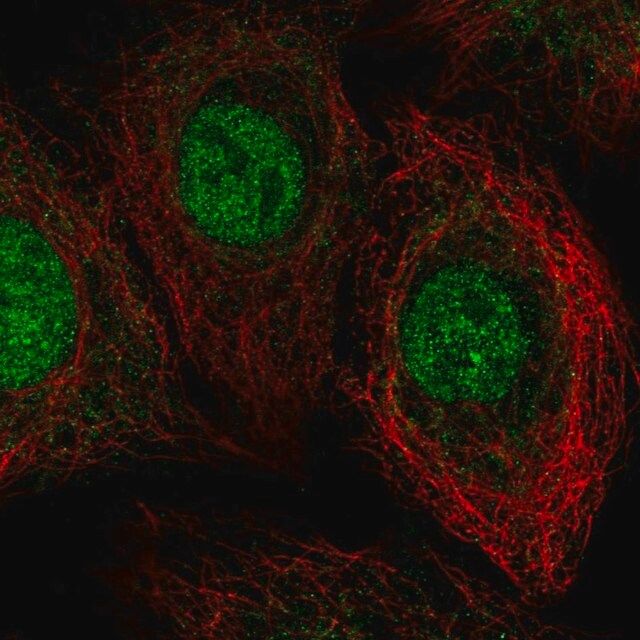 Anti-THAP8 antibody produced in rabbit