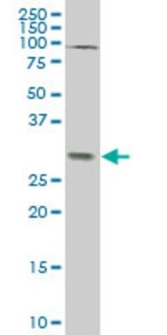 ANTI-TGIF2 antibody produced in mouse