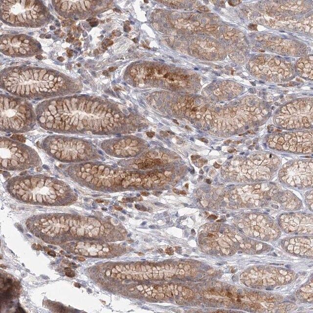 Anti-THNSL1 antibody produced in rabbit