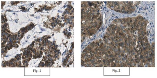 Anti-Thymidylate Kinase/TMPK Antibody, clone 1A5.1