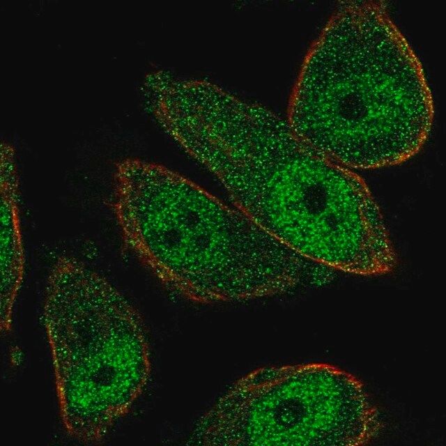 Anti-THSD7B antibody produced in rabbit