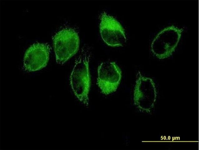 Anti-THBS1 antibody produced in mouse