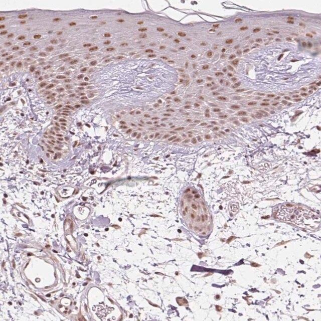 Anti-THOC6 antibody produced in rabbit