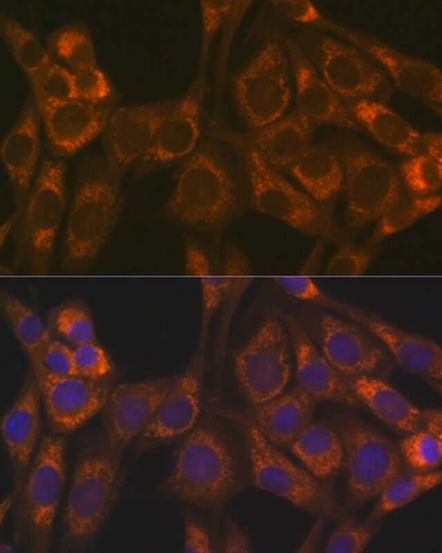 Anti-Thioredoxin 2 (Trx2/TXN2) antibody produced in rabbit