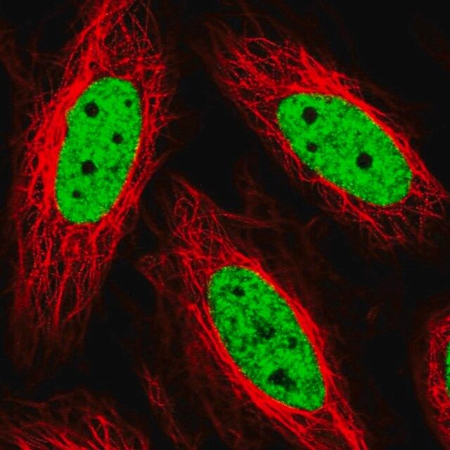 Anti-THRAP3 antibody produced in rabbit