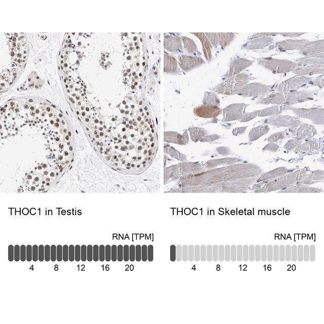 Anti-THOC1 antibody produced in rabbit