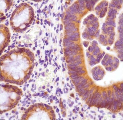 Anti-Thymidylate Synthase antibody, Rabbit monoclonal