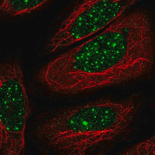 Anti-THRB antibody produced in rabbit