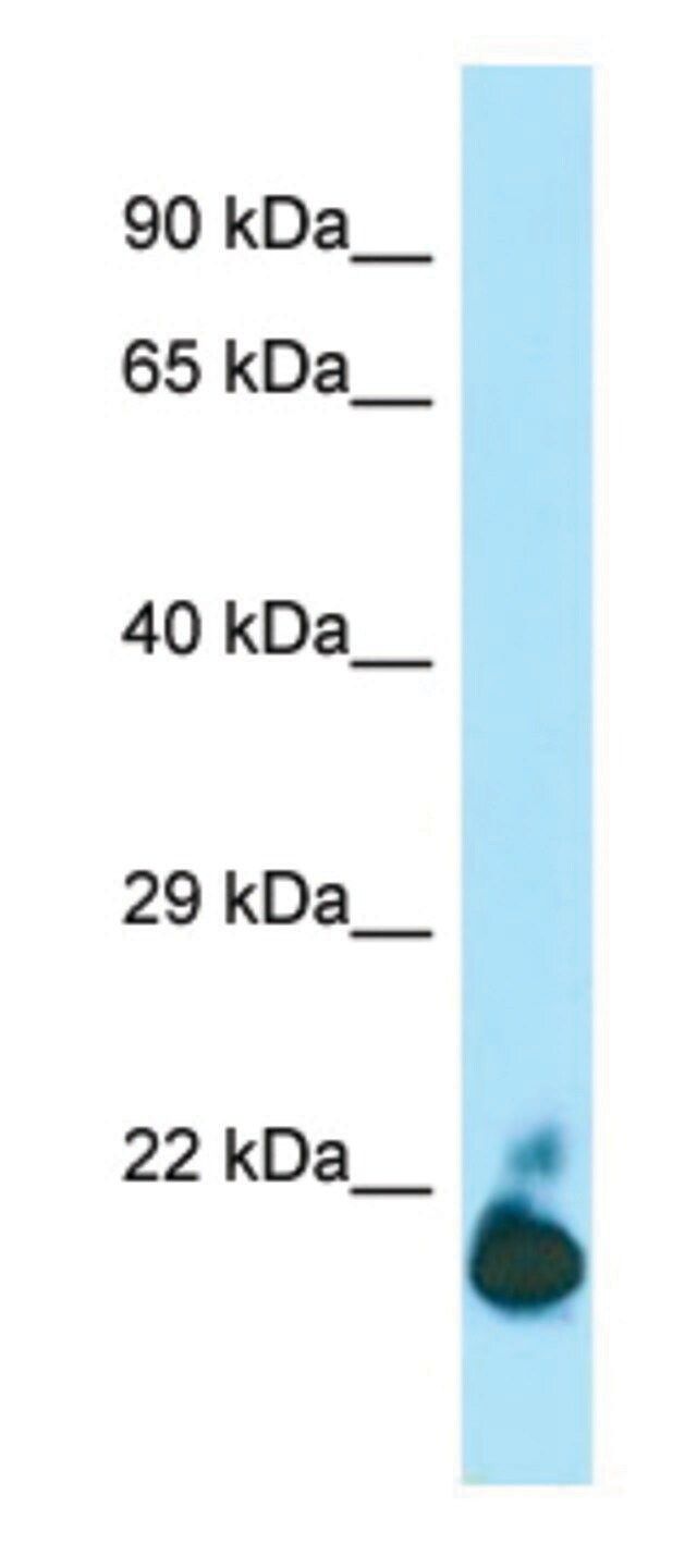 Anti-TIGIT (C-terminal) antibody produced in rabbit