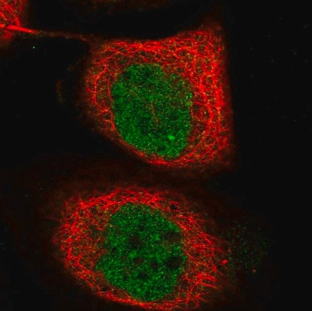 Anti-TICRR antibody produced in rabbit