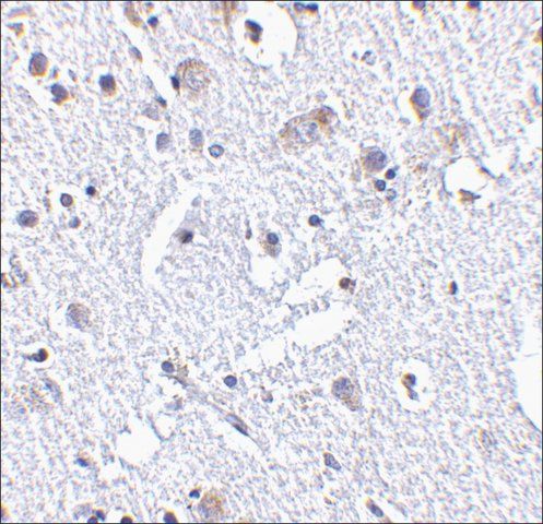 Anti-TIGAR (ab2) antibody produced in rabbit