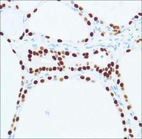 Anti-Thyroid Transcription Factor-1 antibody, Rabbit monoclonal