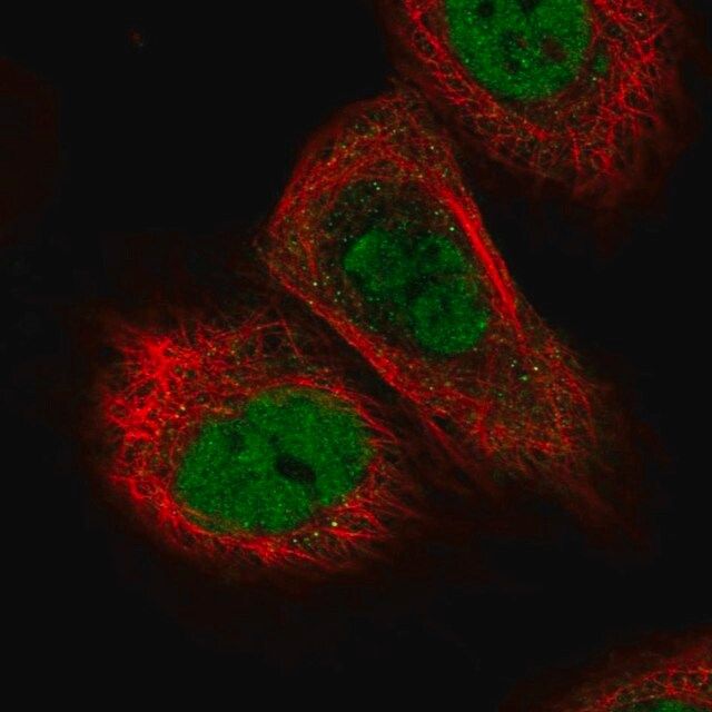 Anti-TICRR antibody produced in rabbit