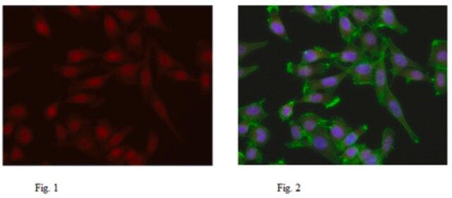 Anti-TIF1-alpha Antibody