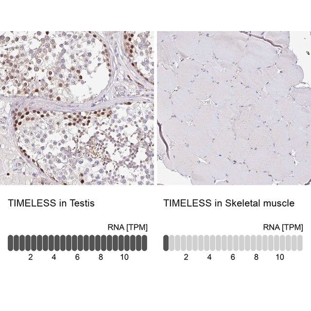 Anti-TIMELESS antibody produced in rabbit