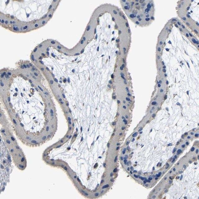 Anti-THSD1 antibody produced in rabbit