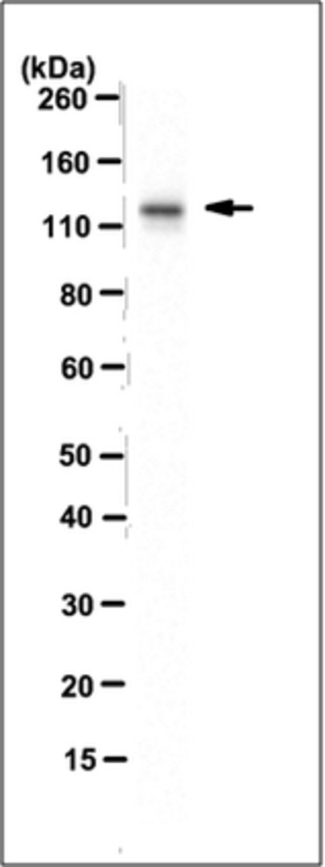 Anti-TAOK1 Antibody (long isoform), clone TAO1_1.2_VMD