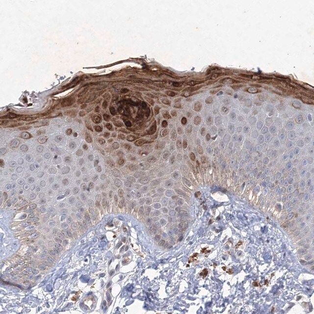 Anti-TANC1 antibody produced in rabbit