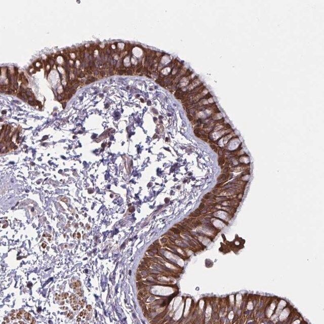 Anti-TANK antibody produced in rabbit