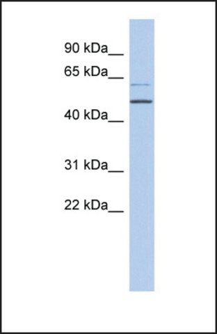 Anti-TBC1D10C, (N-terminal) antibody produced in rabbit