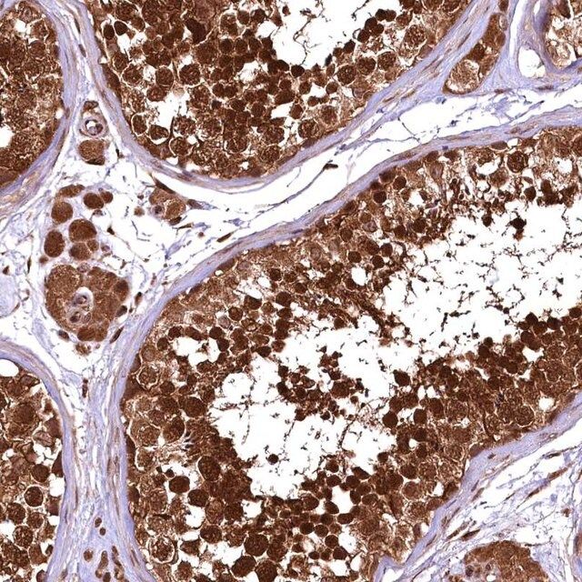 Anti-TBCEL antibody produced in rabbit