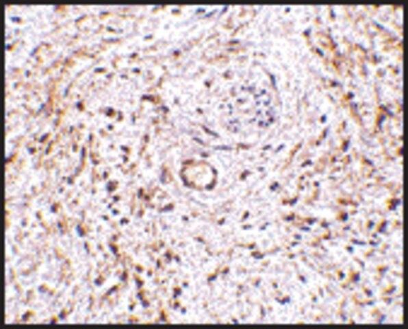 Anti-TEM5 antibody produced in rabbit