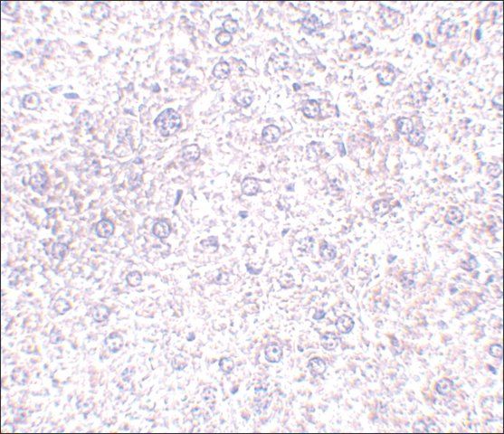 Anti-TEM7 antibody produced in rabbit