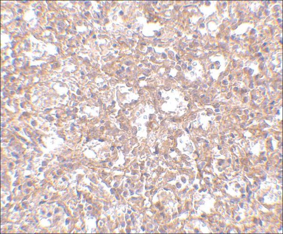 Anti-TEM4 antibody produced in rabbit