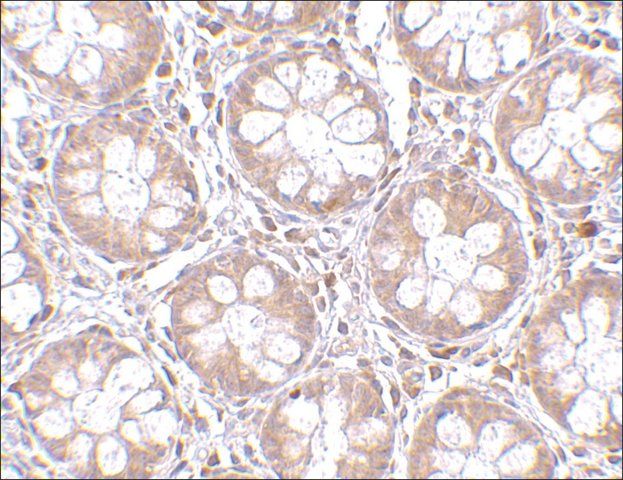 Anti-TEM2 antibody produced in rabbit