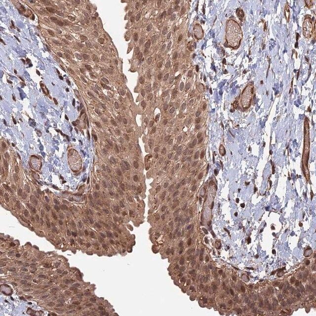 Anti-TELO2 antibody produced in rabbit