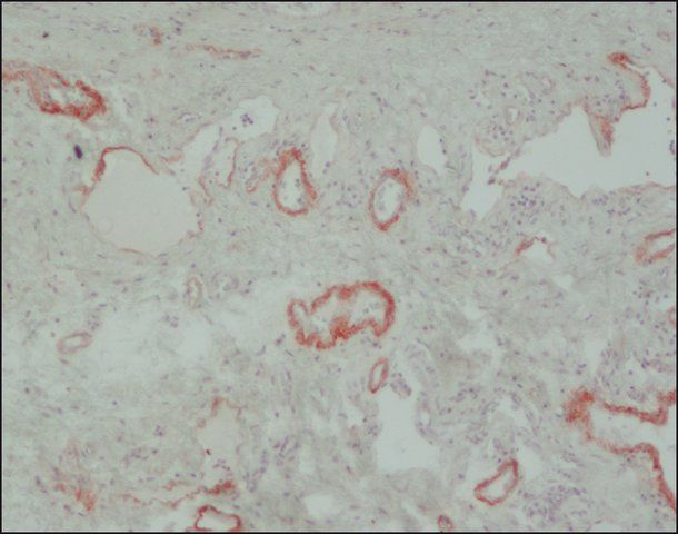 Anti-Tenascin antibody, Mouse monoclonal