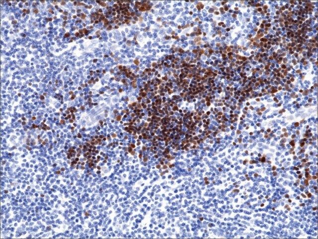 Anti-Terminal deoxynucleotidyl transferase (TdT) antibody, Rabbit monoclonal