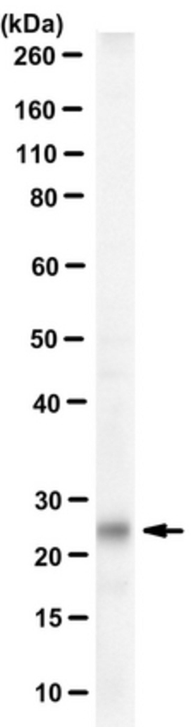 Anti-Tentonin 3/TMEM150c