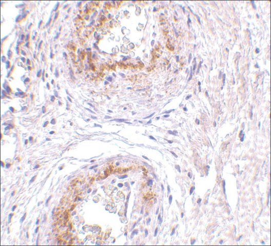 Anti-TEM5 antibody produced in rabbit