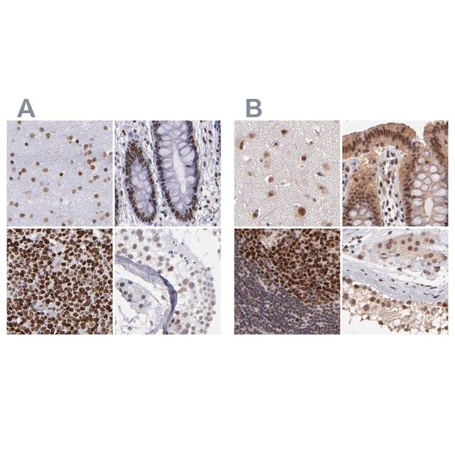 Anti-TERF2 antibody produced in rabbit