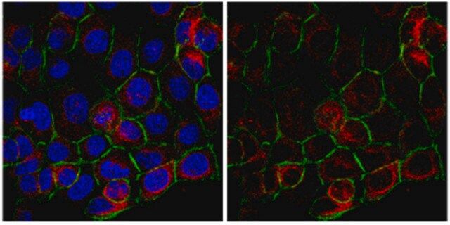 Anti-Tensin-3 Antibody