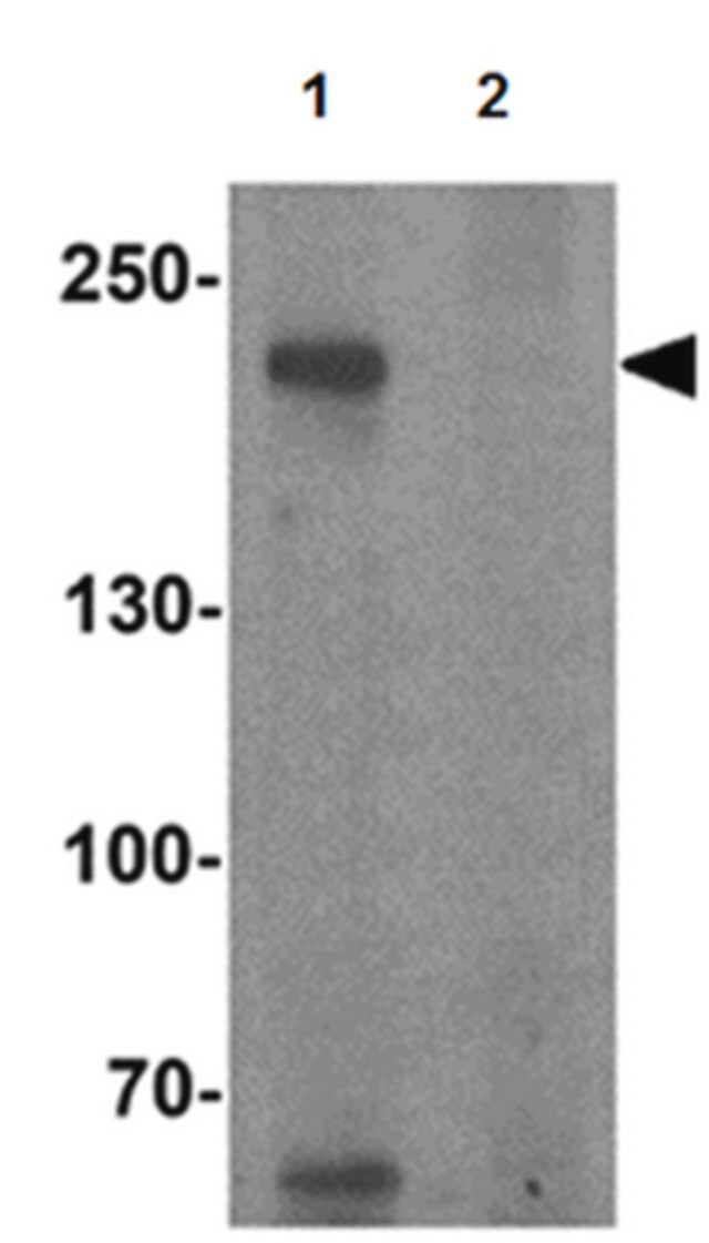 Anti-TET3 Antibody