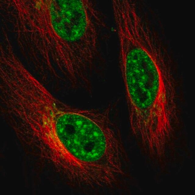 Anti-TEPSIN antibody produced in rabbit