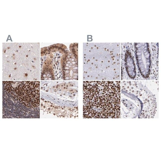 Anti-TERF2 antibody produced in rabbit