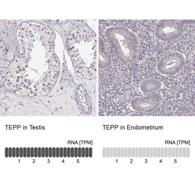 Anti-TEPP antibody produced in rabbit