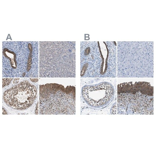 Anti-TES antibody produced in rabbit