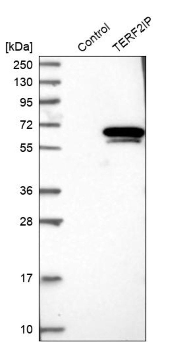 Anti-TERF2IP antibody produced in rabbit