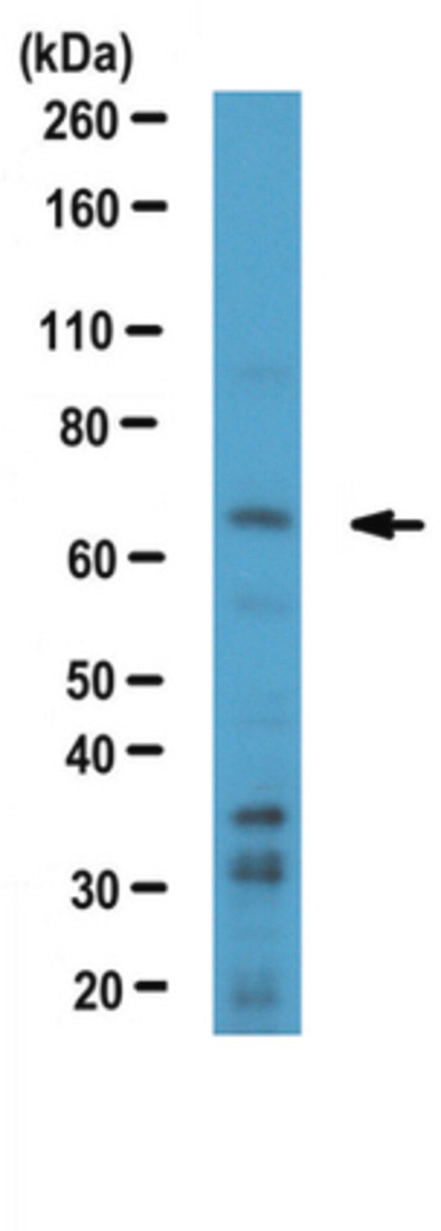 Anti-TFE3 Antibody